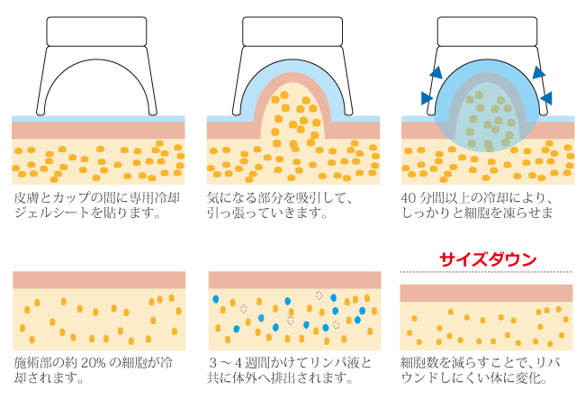 甲賀市水口町のエステサロン｜サロン・ド・エム